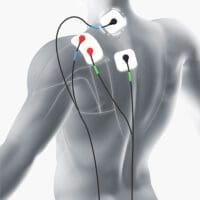 TENS Machine Electrode Placement Guide