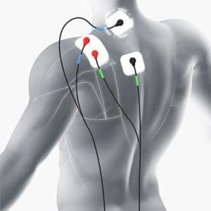 TENS Machine Electrode Placement Guide TENS Machine Electrode Placement Guide