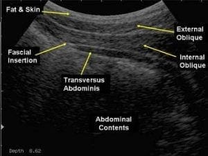 Ultrasound physiotherapy for lower back pain assessment