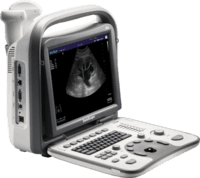 real-time ultrasound