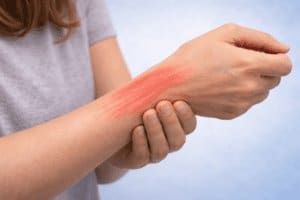 De Quervain’s tenosynovitis physiotherapy assessment of wrist and thumb pain