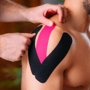 Kinesiology tape applied to shoulder during physiotherapy treatment
